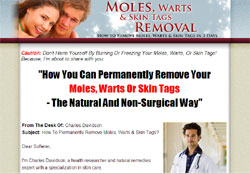 Moles, Warts & Skin Tags Removal