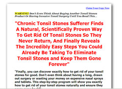 Banish Tonsil Stones: Get Up Close and Personal Again!