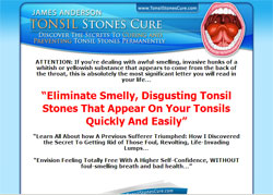 Tonsil Stones Cure