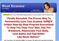 Heal Eczema: The 14 Day Cure Process