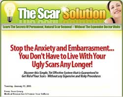The Scar Solution