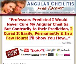 Angular Cheilitis Free Forever