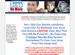Acne No More